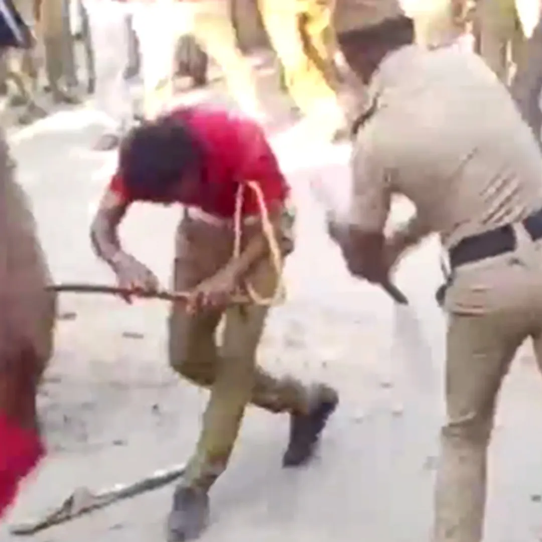 police attack